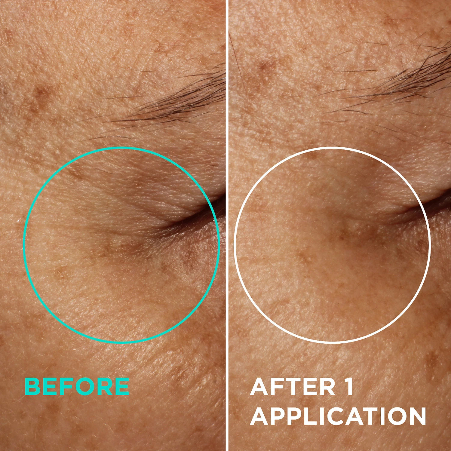 Needles No More Wrinkle Smoothing Cream 1 Needles No More Wrinkle Smoothing Cream