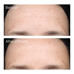 Murad Multi-Vitamin Infusion Oil -Deals Nude Flair Store 2521324cm alt03