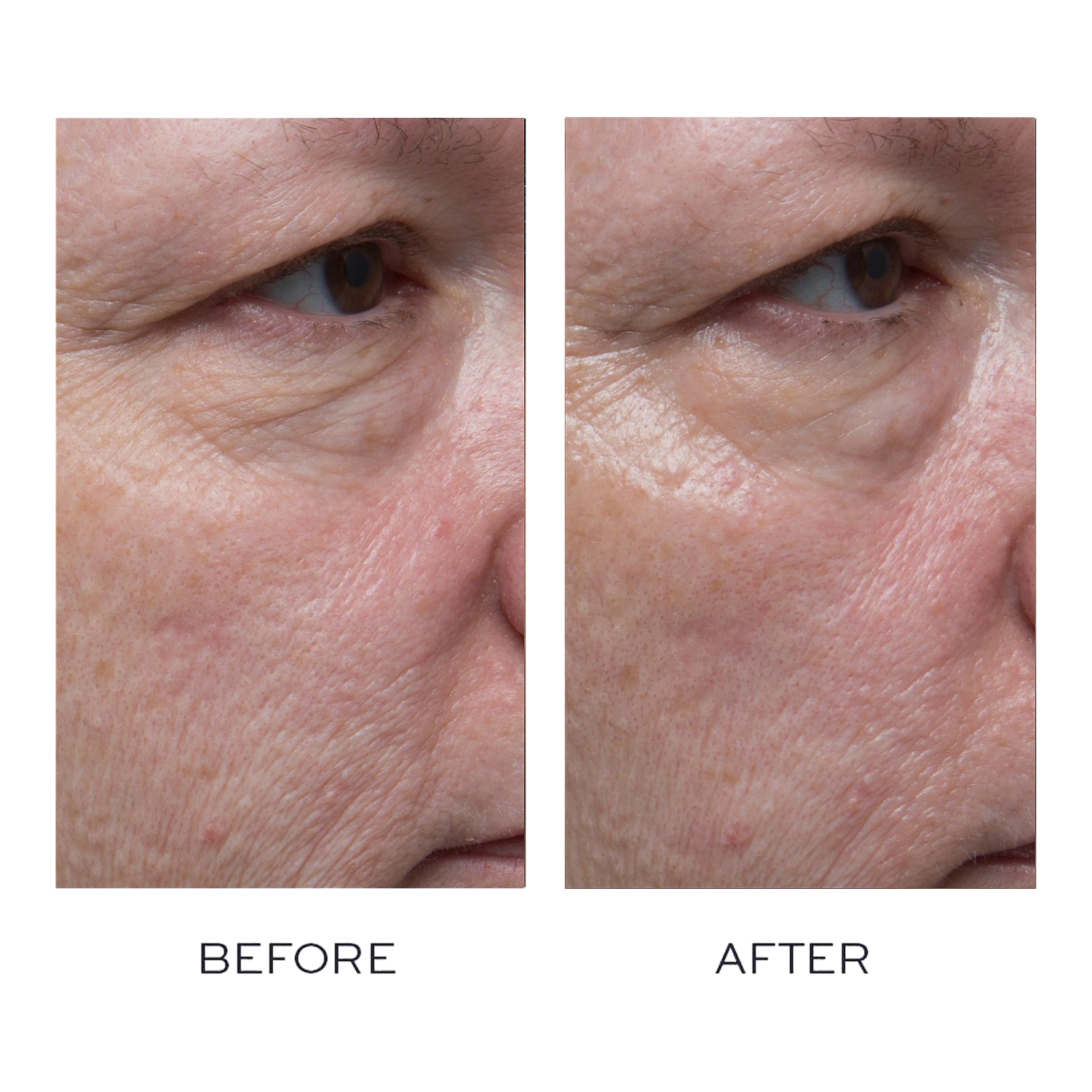 Elemis Pro-Collagen Marine Oil 1 Elemis Pro-Collagen Marine Oil