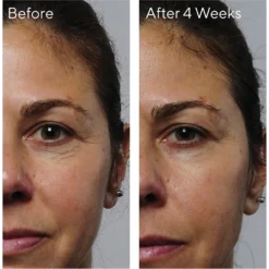 Murad Rapid Collagen Infusion -Deals Nude Flair Store 2544840cm alt03