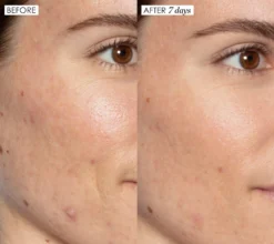 Sunday Riley Good Genes All-In-One Lactic Acid Treatment Serum -Deals Nude Flair Store 2550169 alt02