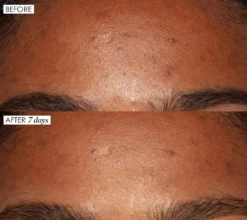 Sunday Riley Good Genes All-In-One Lactic Acid Treatment Serum -Deals Nude Flair Store 2550169 alt03