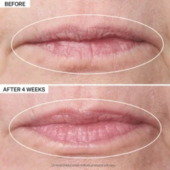 Double Fix For Lips Plumping & Vertical Line Treatment -Deals Nude Flair Store 2550572cm alt01