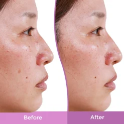 Differin Dark Spot Correcting Serum -Deals Nude Flair Store 2551228cm alt03