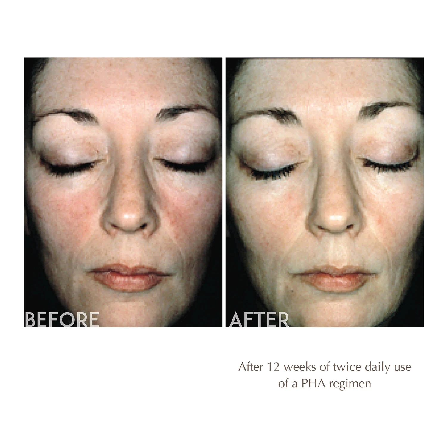 Overnight Transformation Moisturizer Complex 2 Overnight Transformation Moisturizer Complex - Image 2