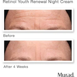 Murad Retinol Youth Renewal Night Cream -Deals Nude Flair Store 2556346cm alt04