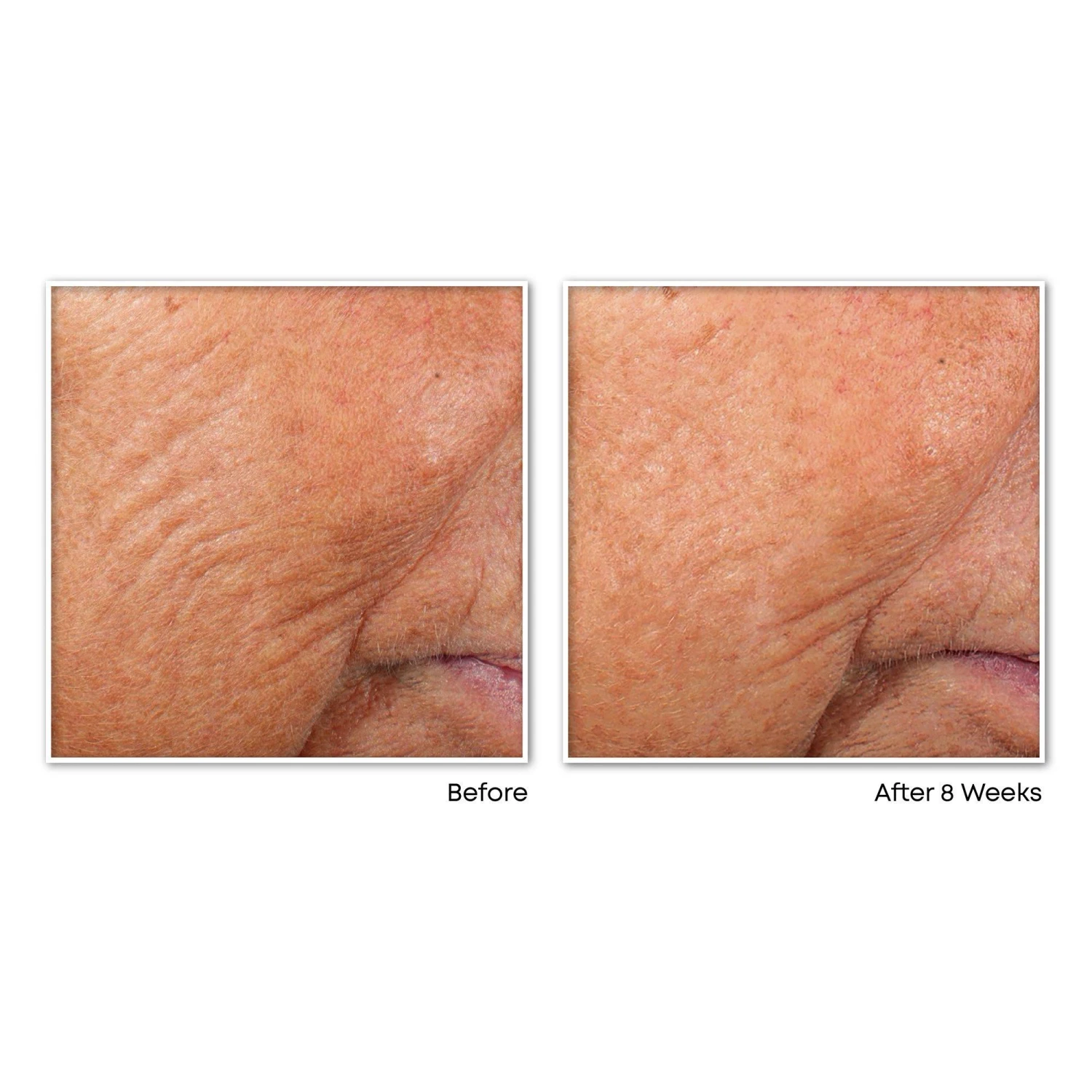 Roc Retinol Correxion Capsules, Anti-Aging Night Retinol Face Serum Anti-Wrinkle Treatment 4 Roc Retinol Correxion Capsules, Anti-Aging Night Retinol Face Serum Anti-Wrinkle Treatment - Image 4