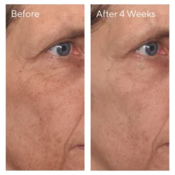 Murad Vitamin C Glycolic Brightening Serum -Deals Nude Flair Store 2562470cm alt02