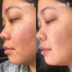 Resurfacing Sleep Mask -Deals Nude Flair Store 2566453cm alt03