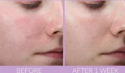 DeliKate Recovery Serum