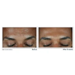 Roc Vitamin C Brightening Serum For Dark Spots & Uneven Tone 1.7 Oz 12 Roc Vitamin C Brightening Serum For Dark Spots & Uneven Tone 1.7 Oz -Deals Nude Flair Store 2567070 alt07