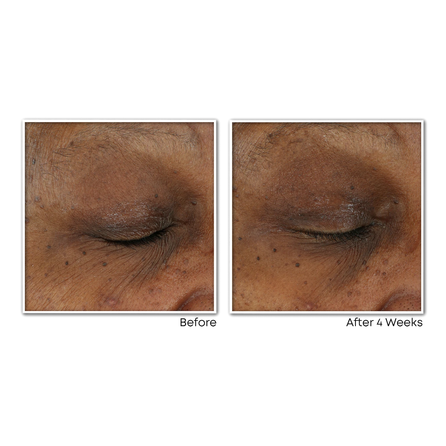 Roc Vitamin C Brightening Serum For Dark Spots & Uneven Tone 1.7 Oz 4 Roc Vitamin C Brightening Serum For Dark Spots & Uneven Tone 1.7 Oz - Image 4