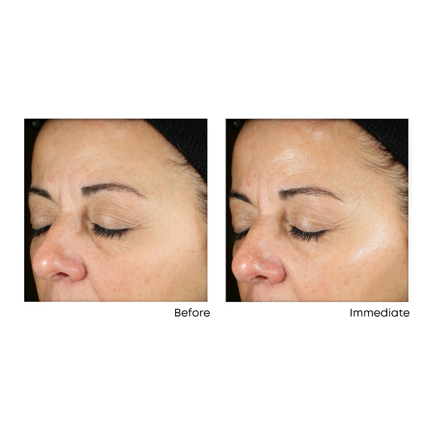 Roc Vitamin C Brightening Serum For Dark Spots & Uneven Tone 1.7 Oz 2 Roc Vitamin C Brightening Serum For Dark Spots & Uneven Tone 1.7 Oz - Image 2