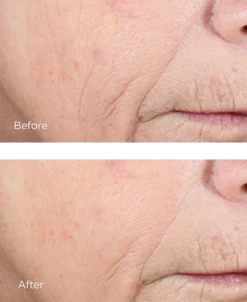 Perricone MD VCE CCC+ Ferulic Brightening Complex 20% -Deals Nude Flair Store 2568107 alt02