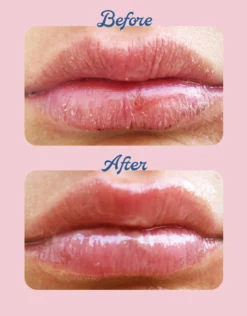 Watermelon 101 Ointment Multi-Balm