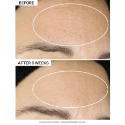 Super-B Barrier Strengthening Oil With Vitamin B3 12 Super-B Barrier Strengthening Oil With Vitamin B3 -Deals Nude Flair Store 2582804cm alt06