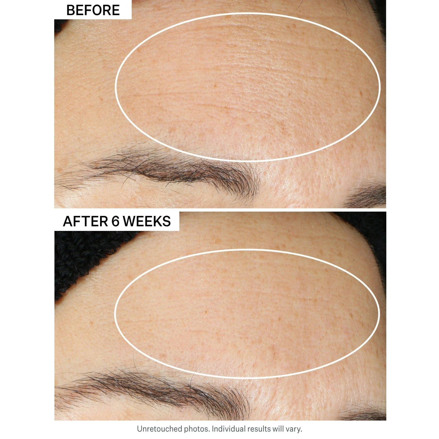 Super-B Barrier Strengthening Oil With Vitamin B3 5 Super-B Barrier Strengthening Oil With Vitamin B3 - Image 5