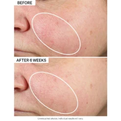 Super-B Barrier Strengthening Oil With Vitamin B3