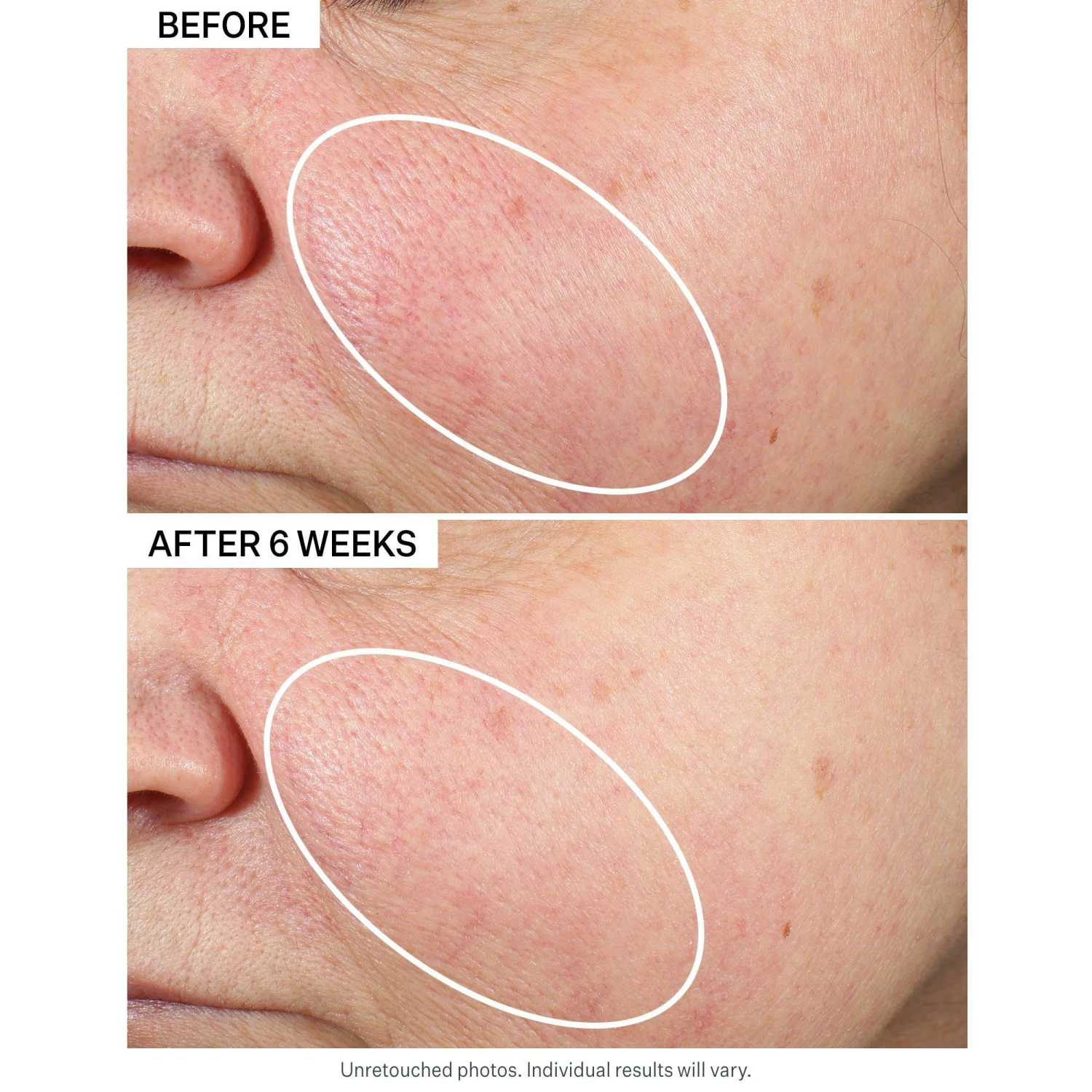 Super-B Barrier Strengthening Oil With Vitamin B3 1 Super-B Barrier Strengthening Oil With Vitamin B3