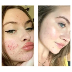 Bright Citrus Serum For Dark Spots -Deals Nude Flair Store 2592178cm alt02