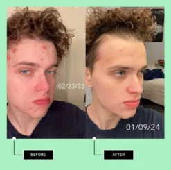 Order Of The Eclipse Hyaluronic Cream -Deals Nude Flair Store 2597528cm alt05