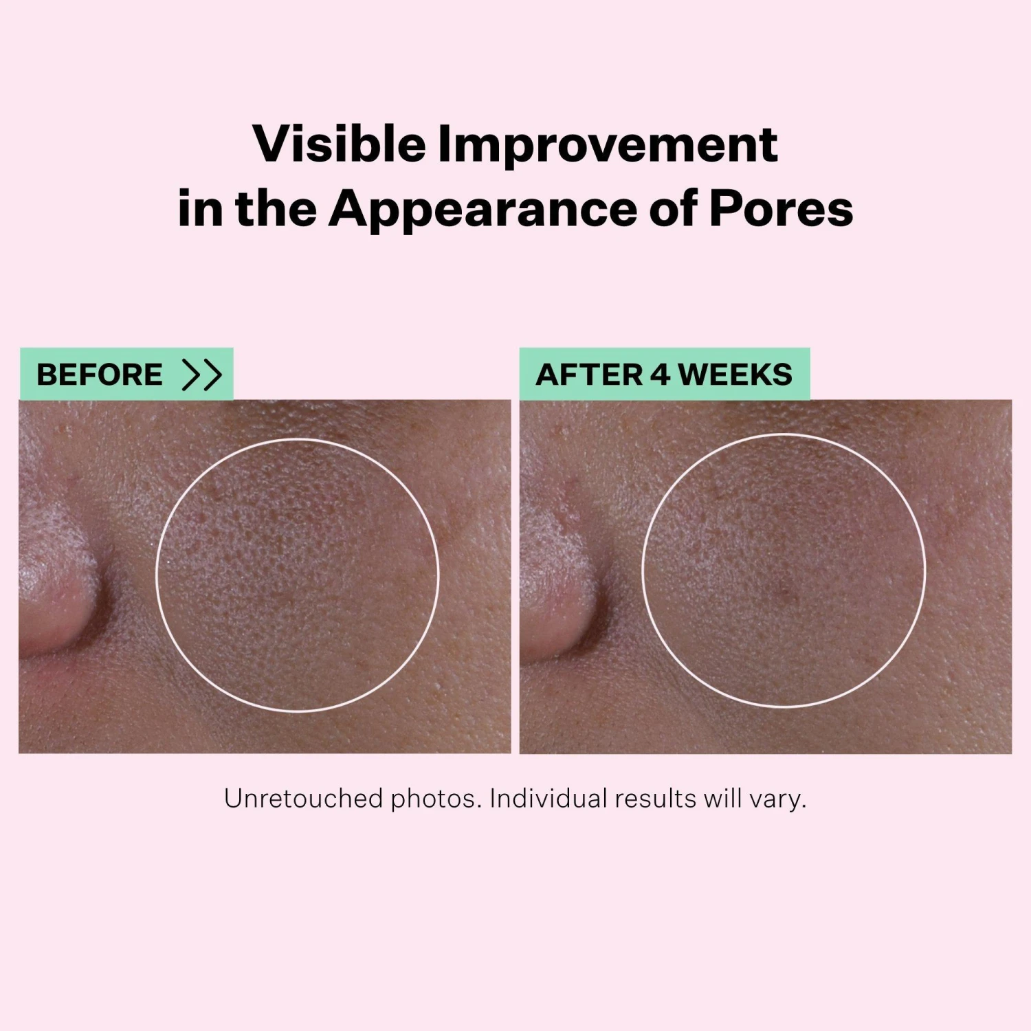 Multi-Action Super Shrink Pore Minimizing Serum 2 Multi-Action Super Shrink Pore Minimizing Serum - Image 2