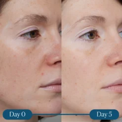 Elemis Dynamic Resurfacing Super-C Serum