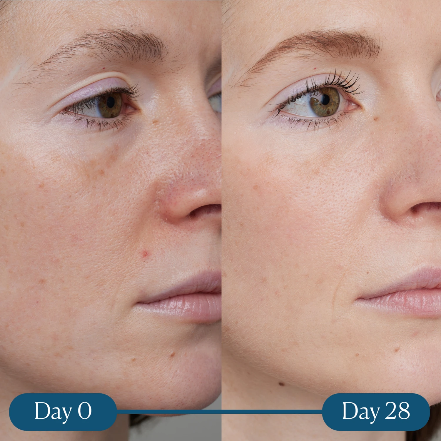 Elemis Dynamic Resurfacing Super-C Serum 2 Elemis Dynamic Resurfacing Super-C Serum - Image 2