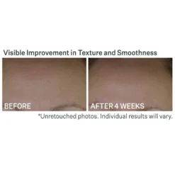 Anti-Wrinkle Peptide Plump Line Filling Bounce Serum -Deals Nude Flair Store 2603502 alt03