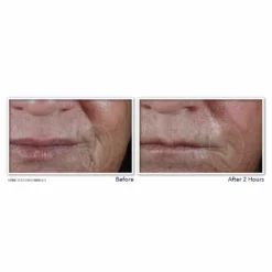 Roc Retinol Correxion Deep Wrinkle Targeted Patches