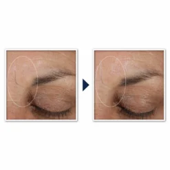 Roc Retinol Correxion Deep Wrinkle Targeted Patches 9 Roc Retinol Correxion Deep Wrinkle Targeted Patches -Deals Nude Flair Store 2605694 alt04