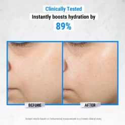 Ultra Pure High-Potency 1.5% Hyaluronic Acid Serum 13 Ultra Pure High-Potency 1.5% Hyaluronic Acid Serum -Deals Nude Flair Store 2607903 alt05