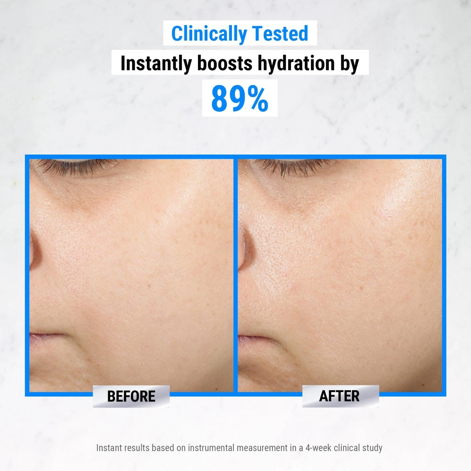 Ultra Pure High-Potency 1.5% Hyaluronic Acid Serum 7 Ultra Pure High-Potency 1.5% Hyaluronic Acid Serum - Image 7