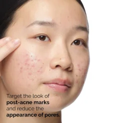 The Ordinary Aloe 2% + NAG 2% Solution Serum -Deals Nude Flair Store 2609862 alt05