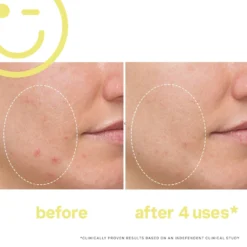 Mega-C 30% Vitamin C Brightening Facial -Deals Nude Flair Store 2611345 alt02