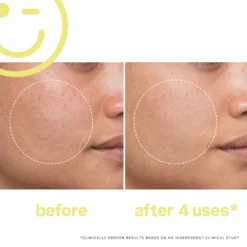 Mega-C 30% Vitamin C Brightening Facial -Deals Nude Flair Store 2611345 alt03