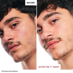 Erborian Skin Therapy Multi-Perfecting Bi-Phase Night Oil-Serum -Deals Nude Flair Store 2614901 alt03